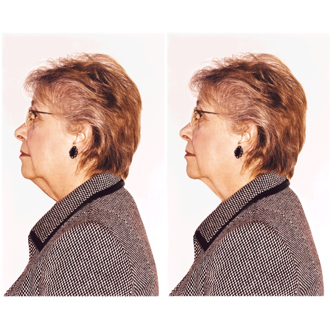 DermaTite Firming & Rejuvenating Neck Cream, , large